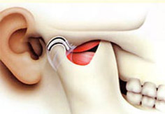 Imagem Cirurgia da ATM